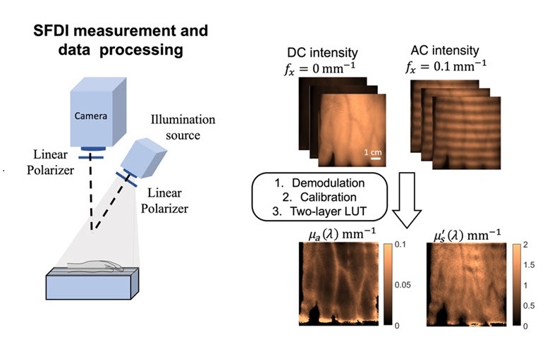 Image: Noninvasive optical imaging effectively tracks diet-induced changes in cardiovascular physiology (Photo courtesy of A. Pilvar et al., doi 10.1117/1.BIOS.1.2.025004)